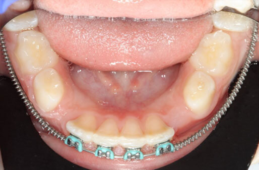 Dental Patient Images