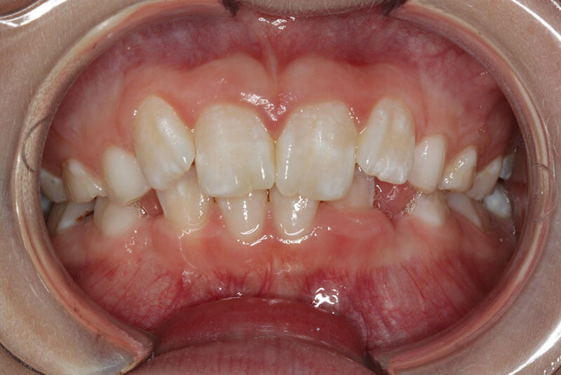Dental Patient Images