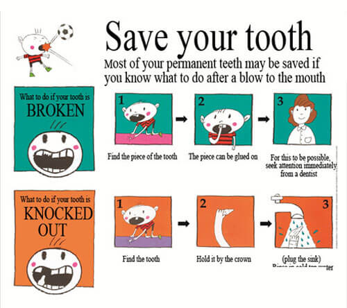 Save your tooth